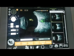 Resolución axial estupenda ultrasónica de la máquina 10MHz del escáner de la función del cálculo de IOL alta