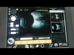 Máquina 10MHz de la exploración de la exploración B del fan observando la separación retiniana