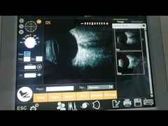 Examen vítreo electromágnetico de la enfermedad del cuerpo de la máquina ultrasónica del escáner de B