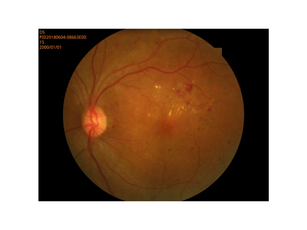 Pequeña alta resolución del modo del alumno de la proyección de imagen de Digitaces de la cámara retiniana del fondo