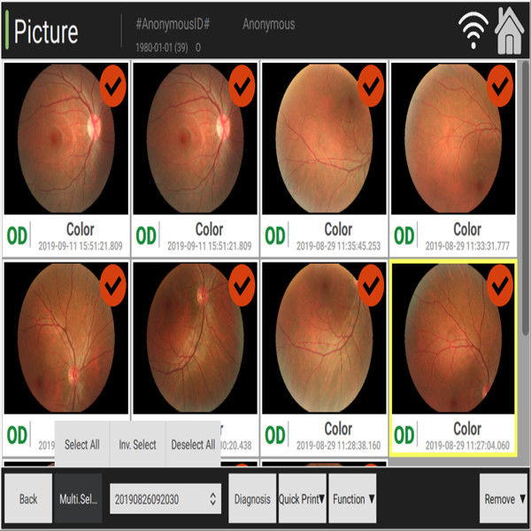 cámara automatizada 3.3m m del fondo observando el cambio del color de la atrofia del nervio óptico